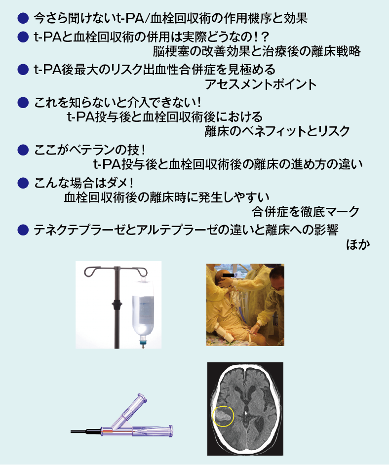 画像に alt 属性が指定されていません。ファイル名: stroke_mobi4-03.png